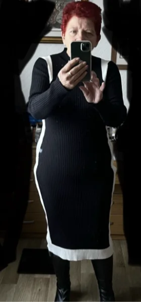 Gastric Sleeve After