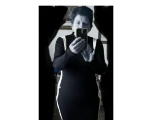 Gastric Sleeve at 64