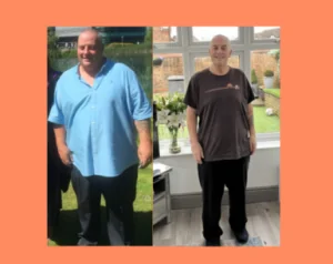 Paul’s Gastric Bypass Before and After