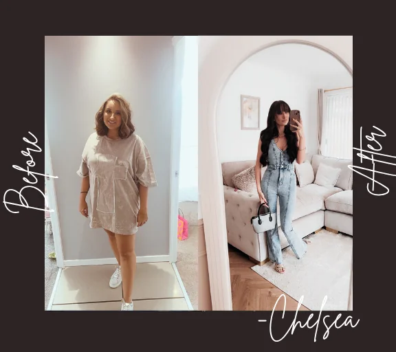 Chelsea - Gastric sleeve review