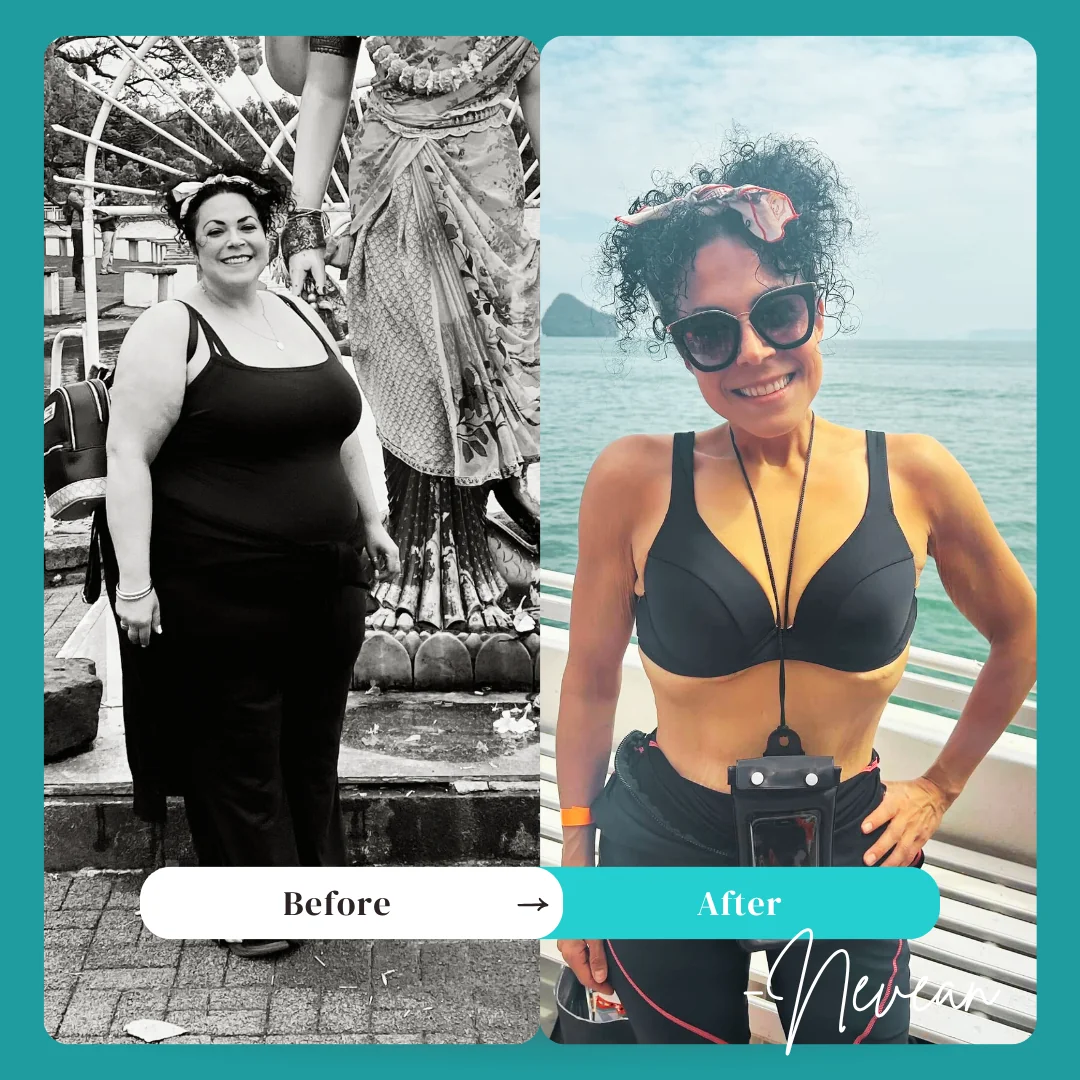 Gastric Bypass Before and After - Nevean