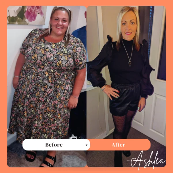 Gastric Bypass surgery before and after - Ashlea Review