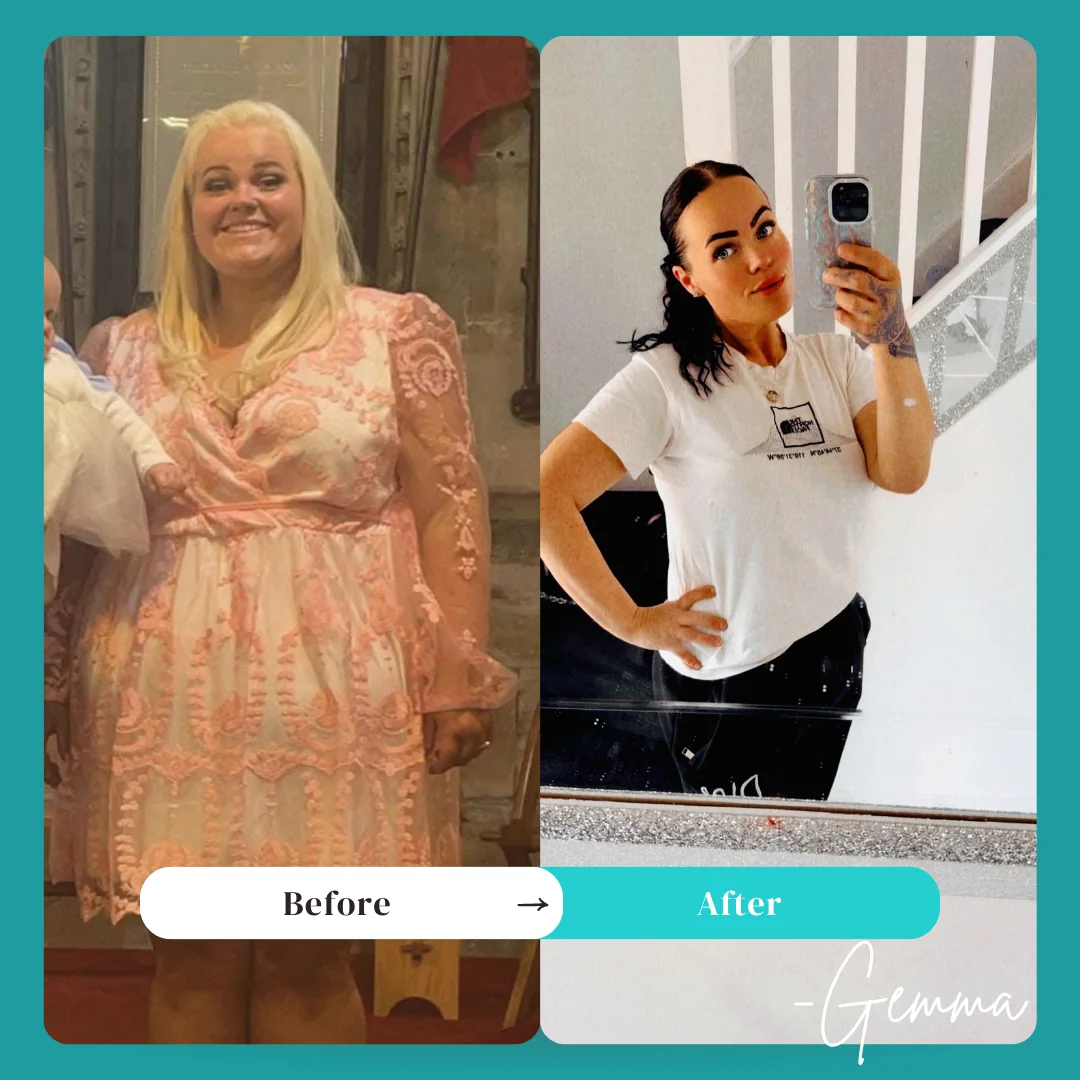Gemma weight loss surgery before and after