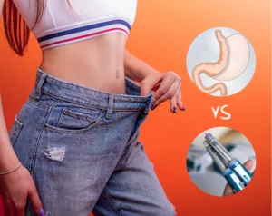 How Effective Is Bariatric Surgery Compared to Weight Loss Medications