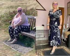 Kathleen before and after weight loss surgery