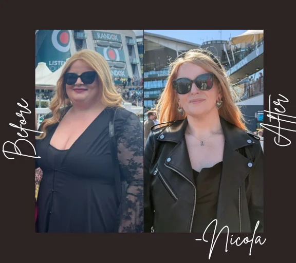 Nicola weight loss surgery review