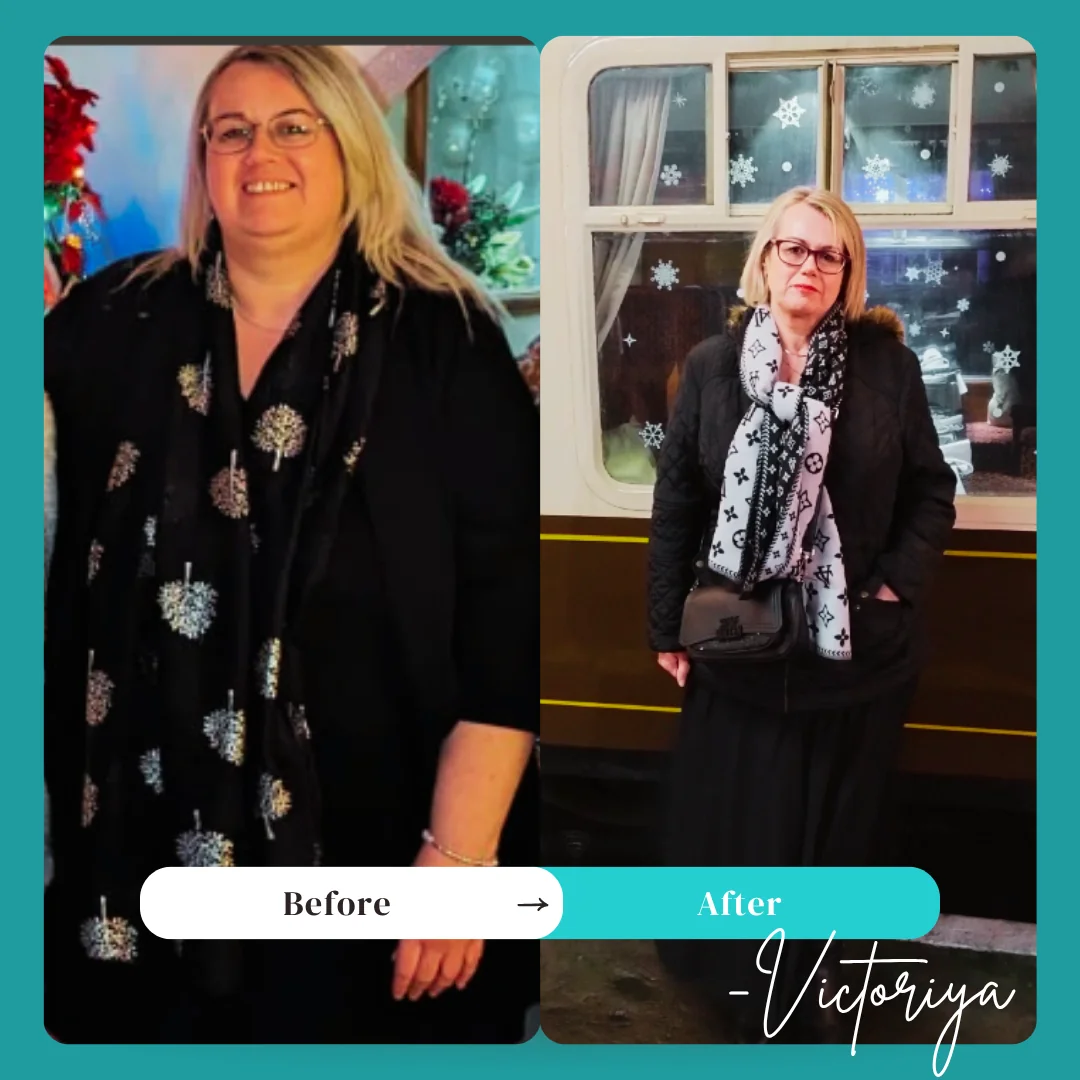 Weight Loss Surgery Before and After