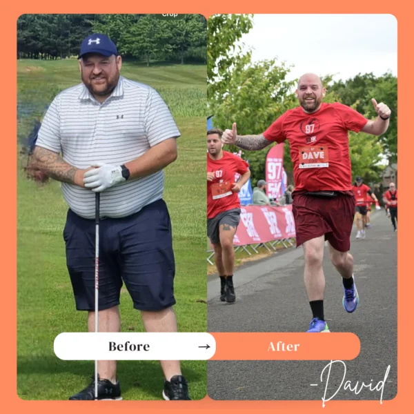 David Weight Loss surgery review