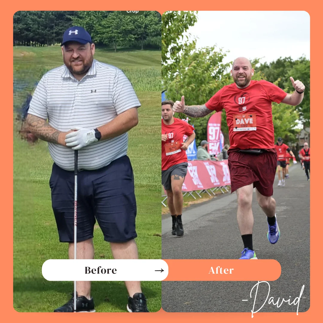 David Weight Loss surgery review