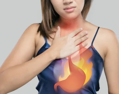 Acid Reflux After Gastric Sleeve