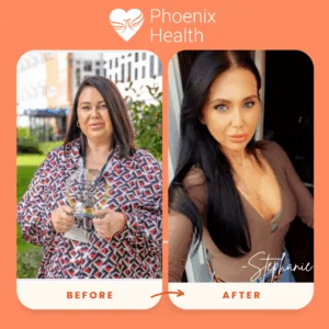 Stephanie weight loss story