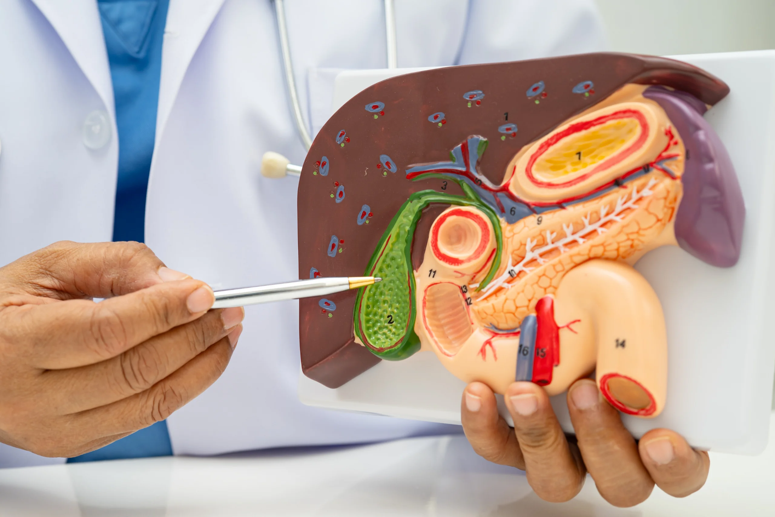 gallbladder removal surgery