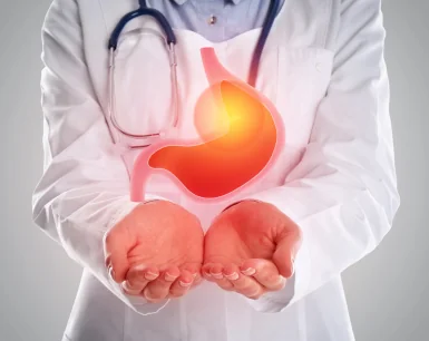 Acid Reflux After Gastric Sleeve