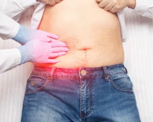 Foods to avoid when gallstones