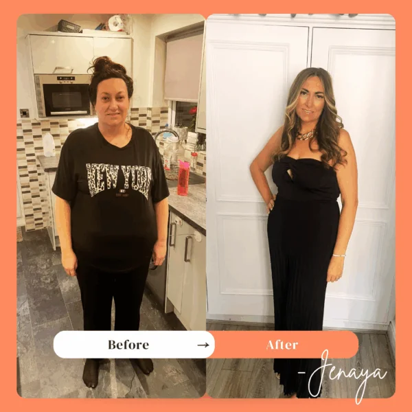 Jeneya before and after gastric sleeve