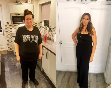 Jeneya gastric sleeve success stories