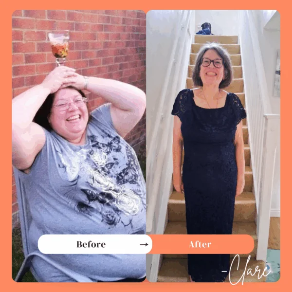 Clare - OAGB before and after