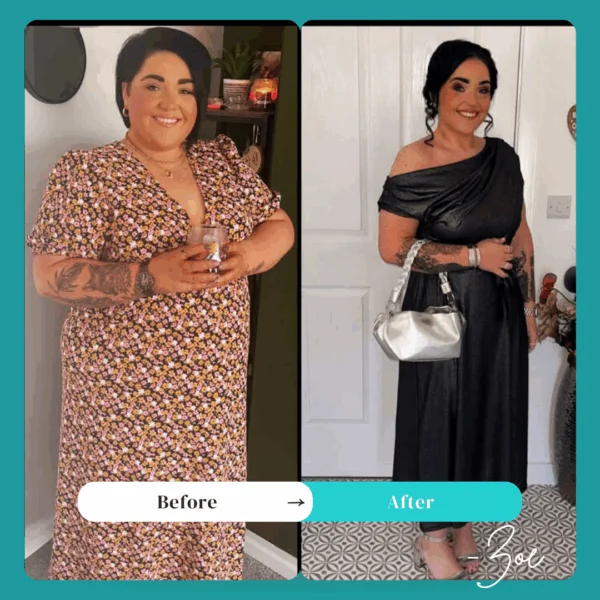 Zoe - gastric bypass review