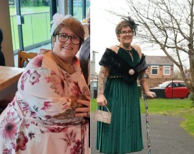 Teresa Before and after