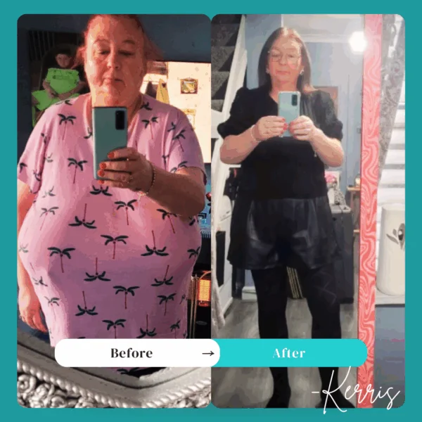 Kerris Before and After