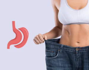 Is Gastric Sleeve Reversible